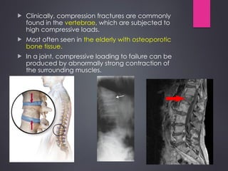Comprehensive Biomechanics of Bones: Structure, Loading, and Fracture ...