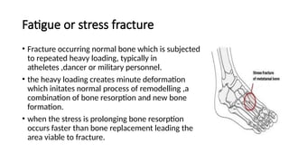 Comprehensive Biomechanics of Fracture: Bone Properties, Forces, and ...