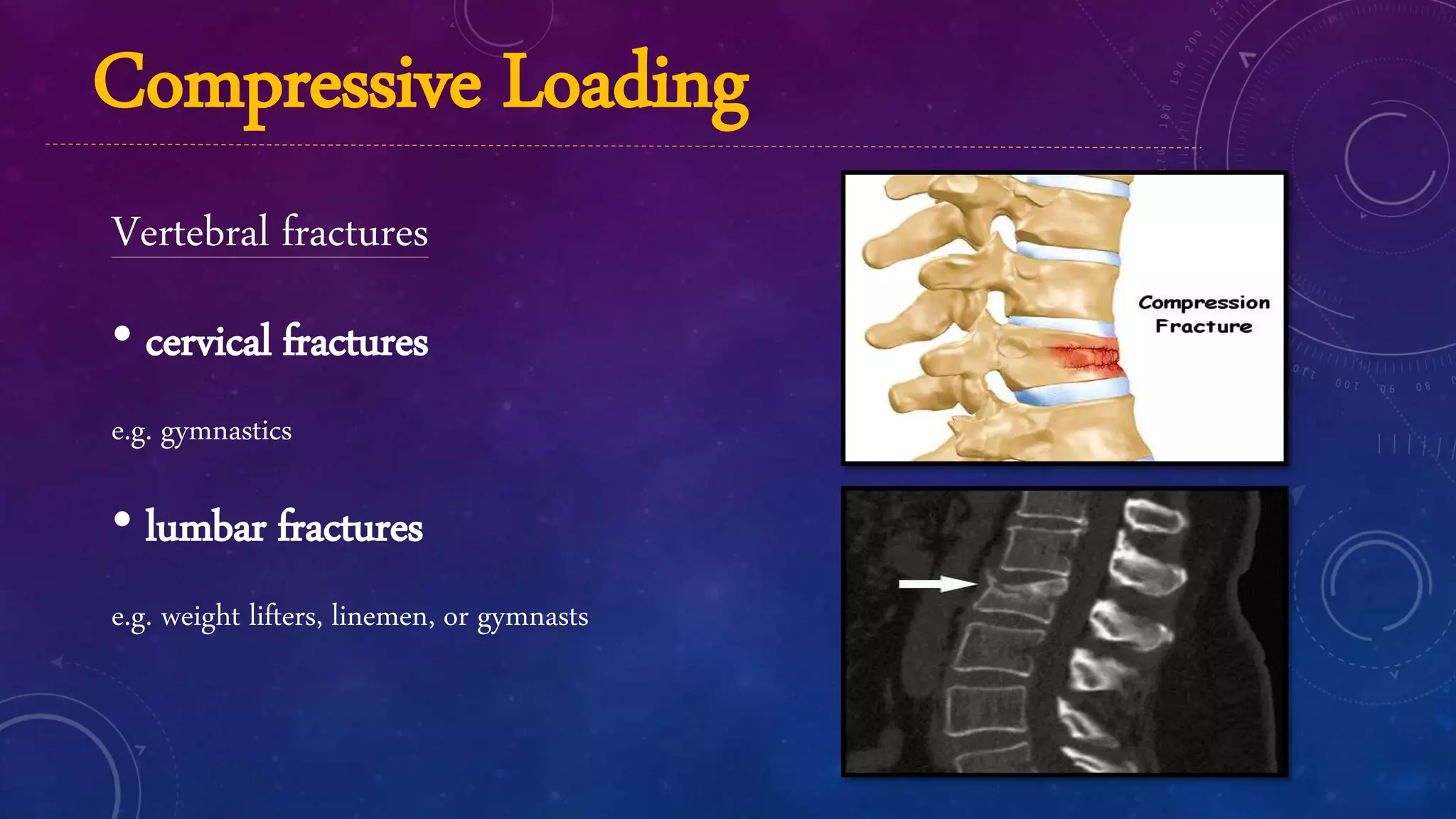 Biomechanics of fracture and fracture healing | PPTX