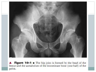Hip Complex Biomechanics of hip complex 1 | PPTX