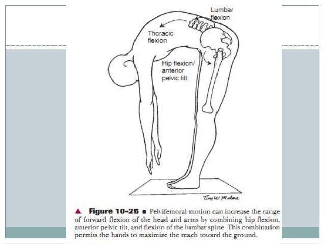 Anterior rotated hip