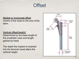 Offset In Radiography Biomechanics of hip and thr | PPTX