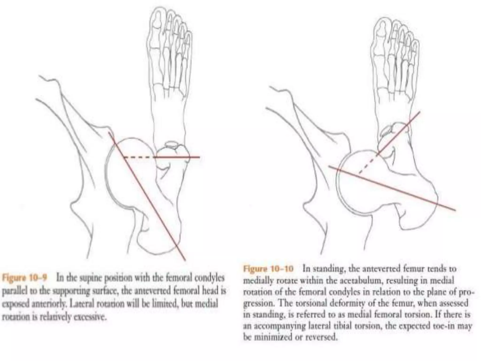 BIOMECHANICS OF HIP JOINT | PPTX