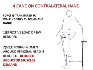 Define Contralateral Loading BIOMECHANICS OF HIP JOINT | PPTX