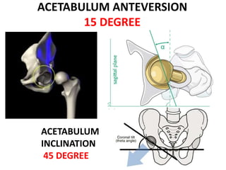 BIOMECHANICS OF HIP JOINT | PPTX
