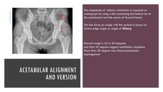 biomechanics of hip ppt for post graduates | PPTX