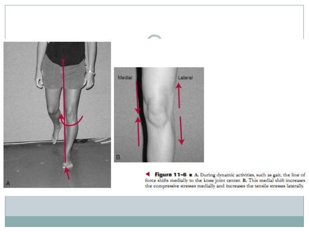 Biomechanics of knee complex 1