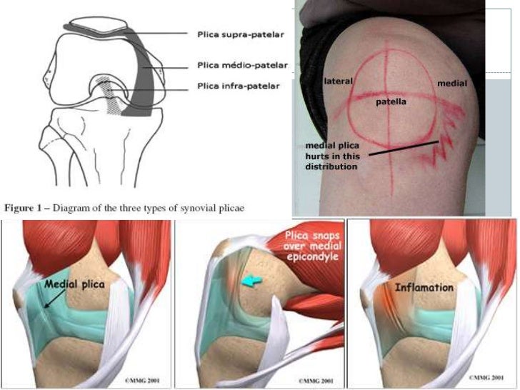 Biomechanics of knee complex 3