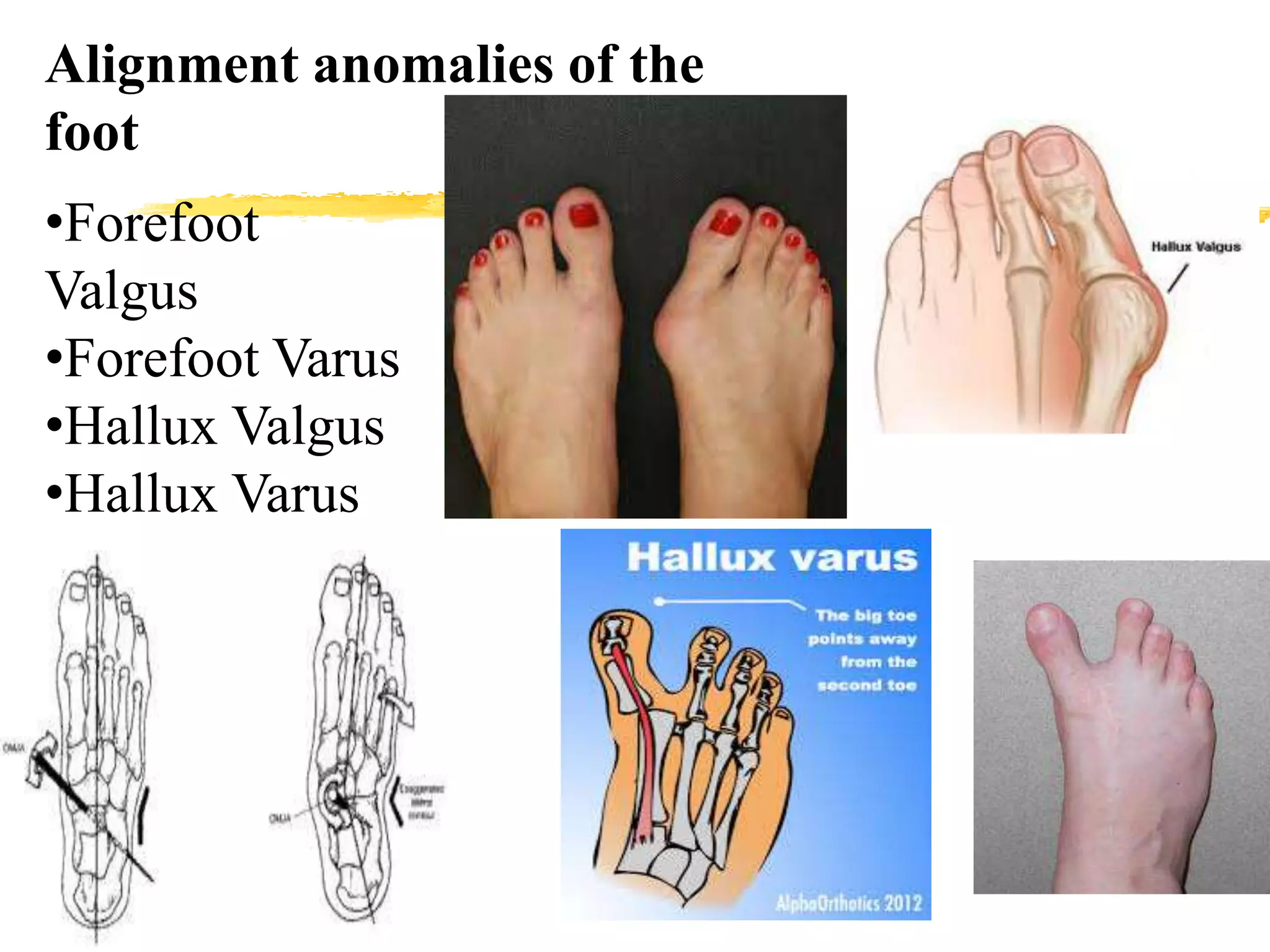 Biomechanics of lower Limb | PPT