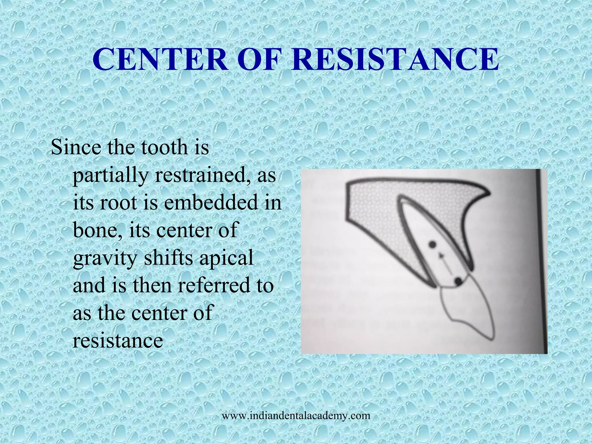 CENTER OF RESISTANCE
Since the tooth is
partially restrained, as
its root is embedded in
bone, its center of
gravity shifts apical
and is then referred to
as the center of
resistance
www.indiandentalacademy.com
 