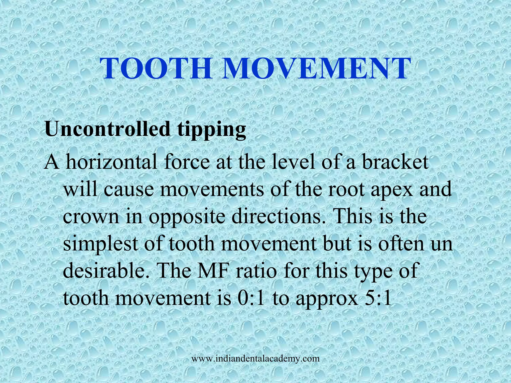 TOOTH MOVEMENT
Uncontrolled tipping
A horizontal force at the level of a bracket
will cause movements of the root apex and
crown in opposite directions. This is the
simplest of tooth movement but is often un
desirable. The MF ratio for this type of
tooth movement is 0:1 to approx 5:1
www.indiandentalacademy.com
 