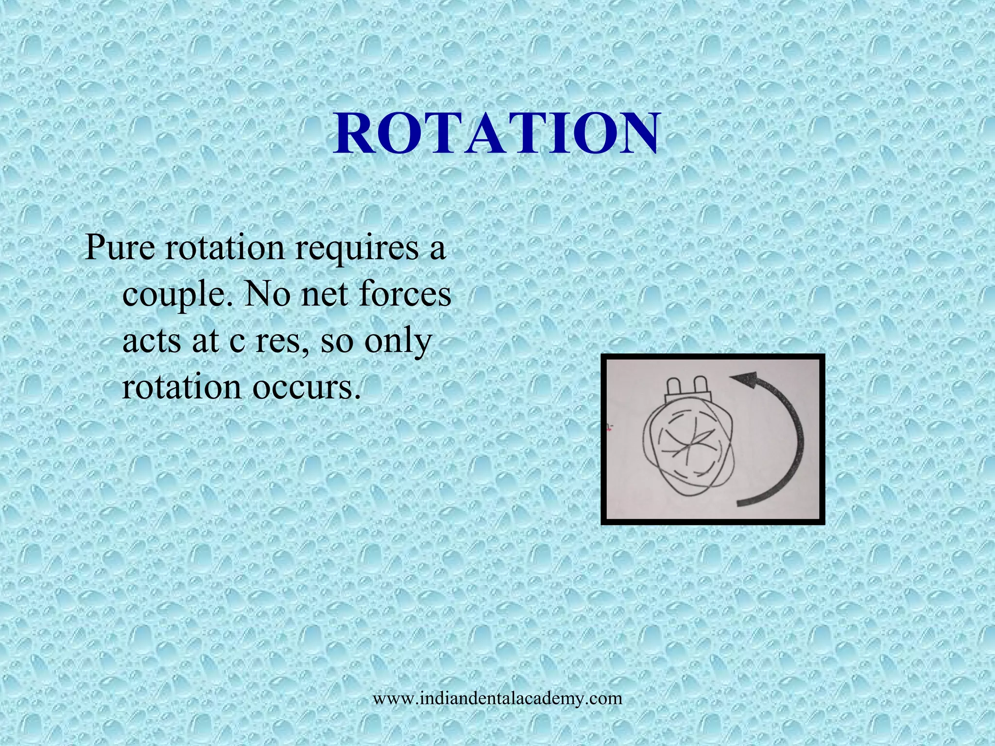 ROTATION
Pure rotation requires a
couple. No net forces
acts at c res, so only
rotation occurs.
www.indiandentalacademy.com
 