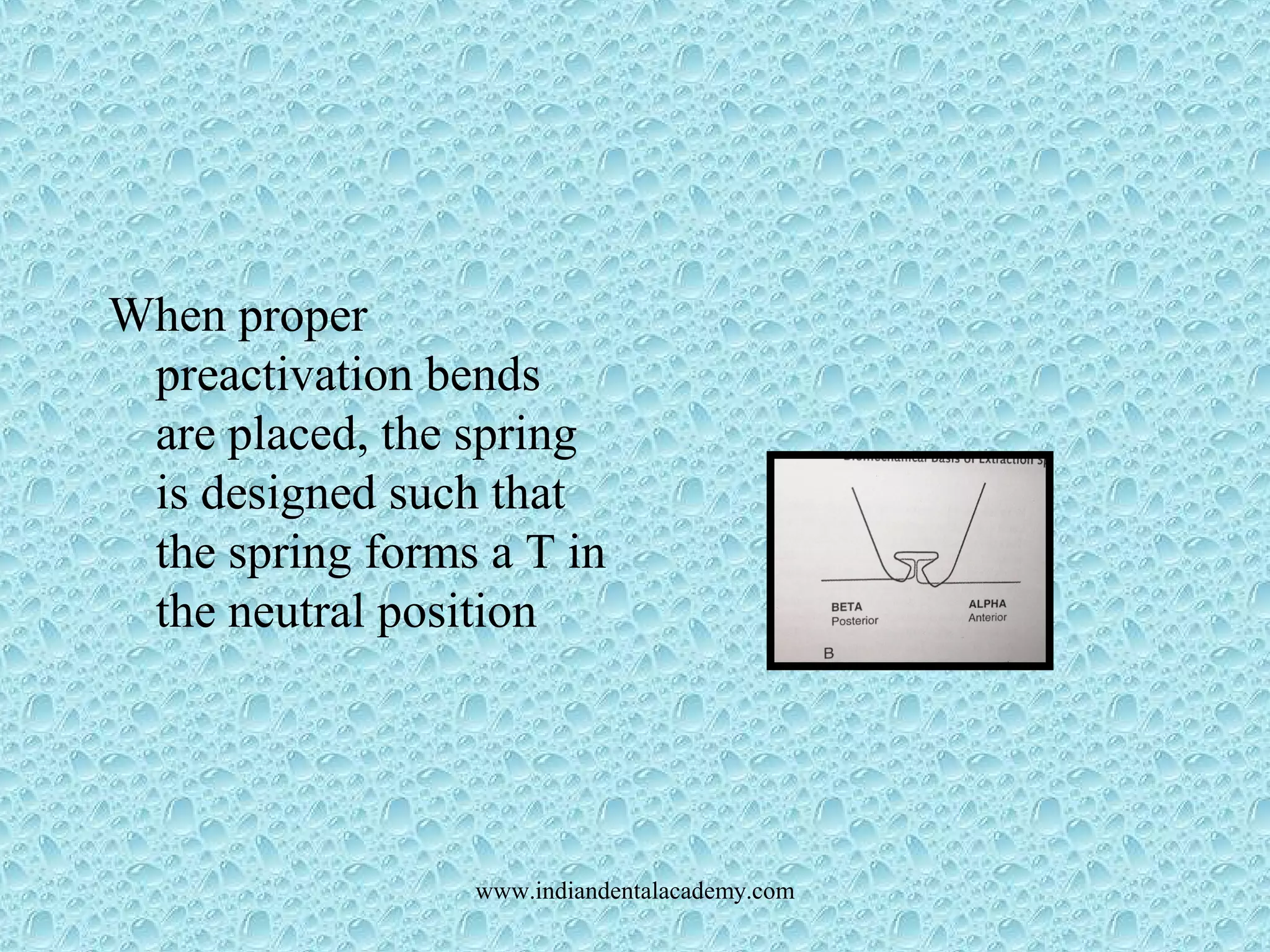 When proper
preactivation bends
are placed, the spring
is designed such that
the spring forms a T in
the neutral position
www.indiandentalacademy.com
 