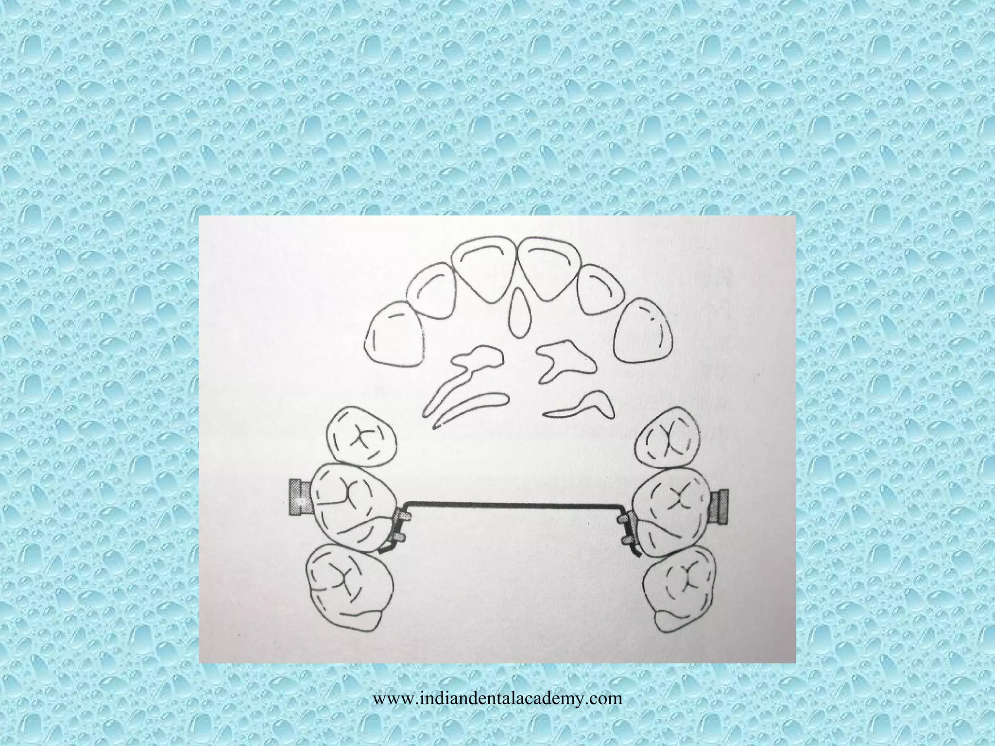 www.indiandentalacademy.com
 
