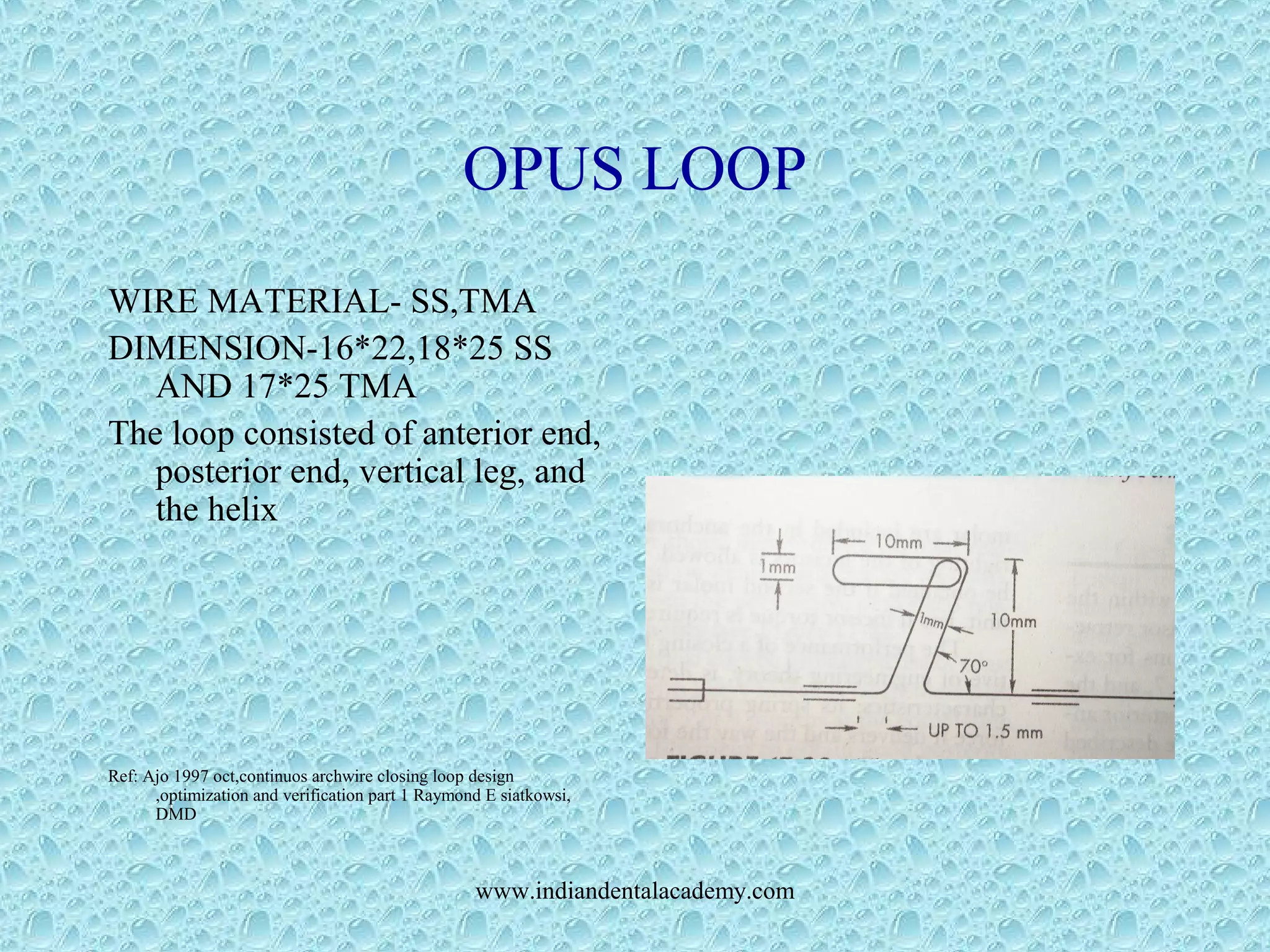 OPUS LOOP
WIRE MATERIAL- SS,TMA
DIMENSION-16*22,18*25 SS
AND 17*25 TMA
The loop consisted of anterior end,
posterior end, vertical leg, and
the helix
Ref: Ajo 1997 oct,continuos archwire closing loop design
,optimization and verification part 1 Raymond E siatkowsi,
DMD
www.indiandentalacademy.com
 