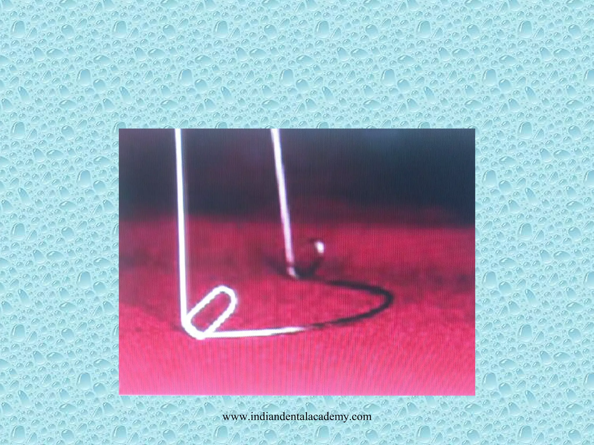 www.indiandentalacademy.com
 