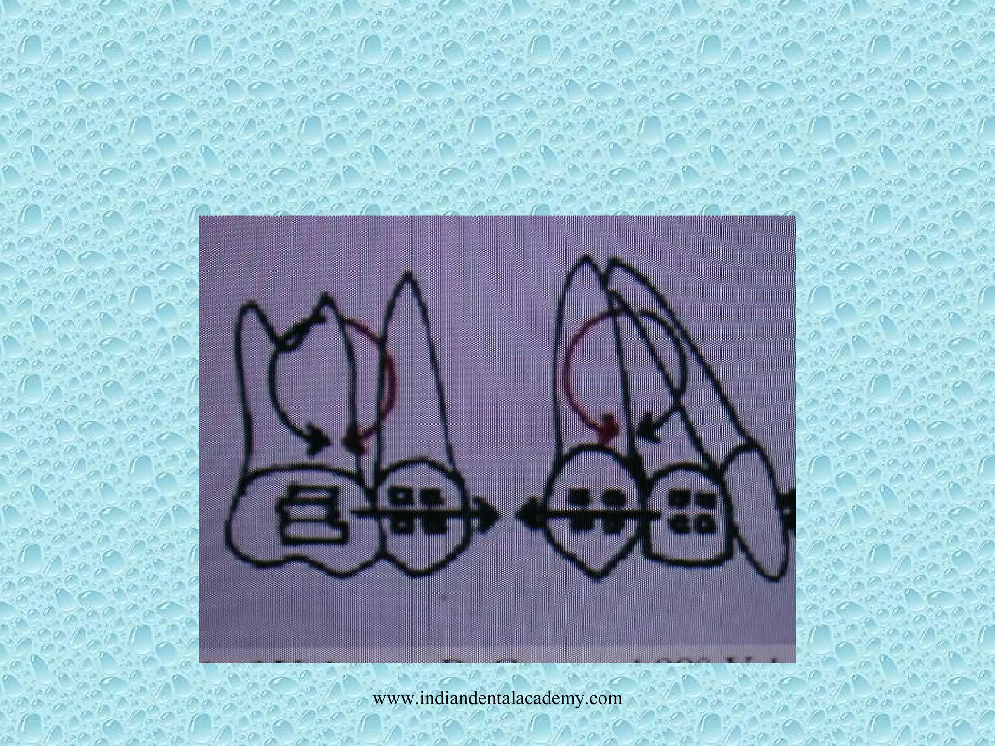 www.indiandentalacademy.com
 