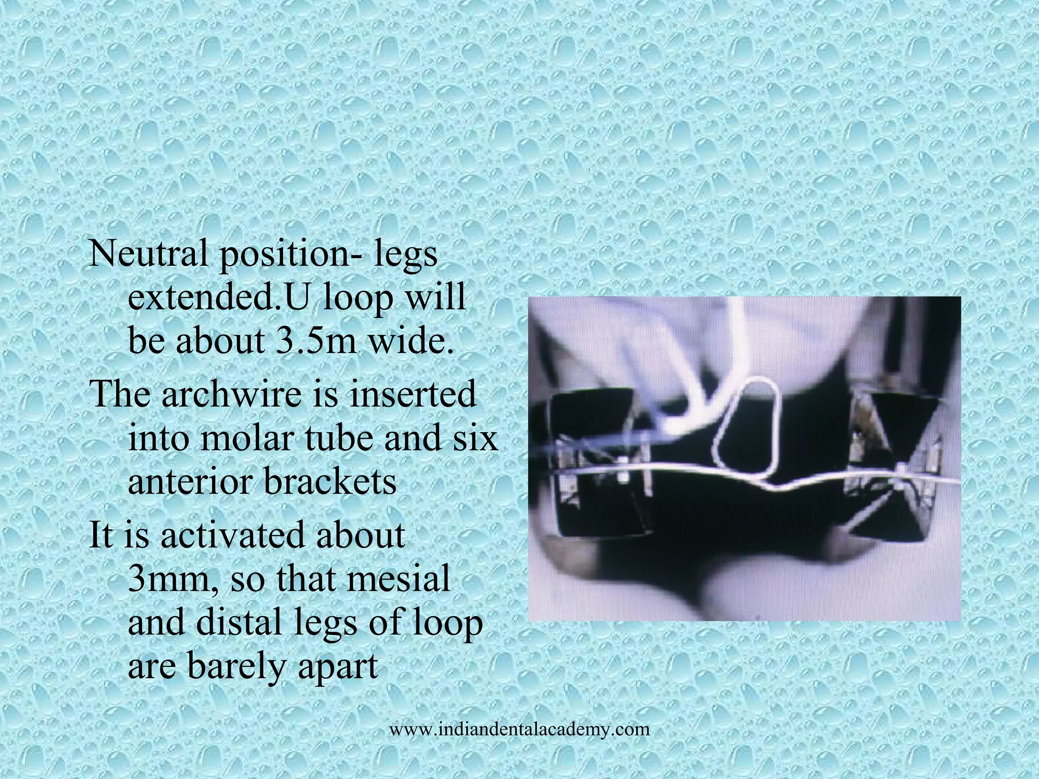 Neutral position- legs
extended.U loop will
be about 3.5m wide.
The archwire is inserted
into molar tube and six
anterior brackets
It is activated about
3mm, so that mesial
and distal legs of loop
are barely apart
www.indiandentalacademy.com
 