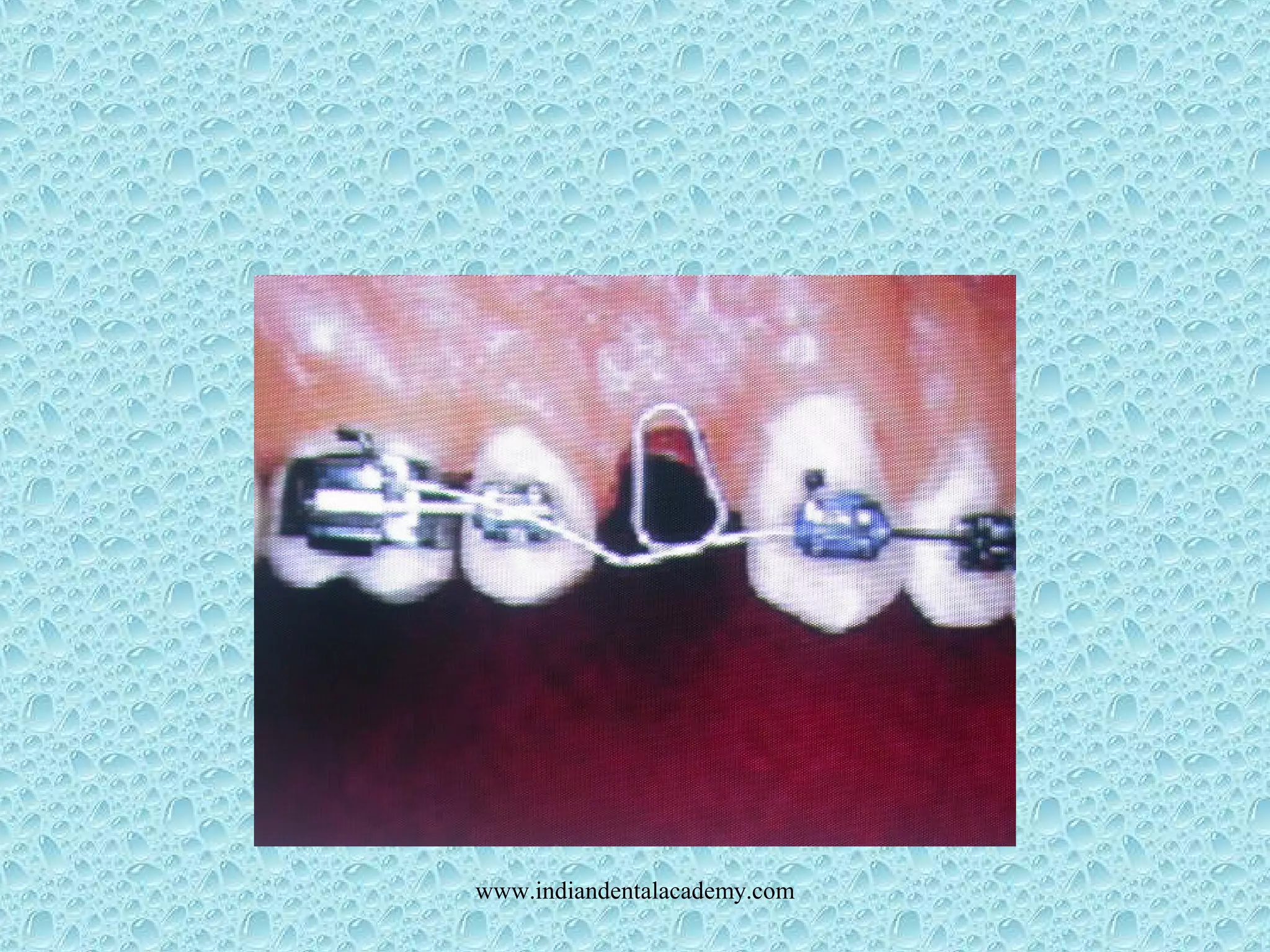 www.indiandentalacademy.com
 