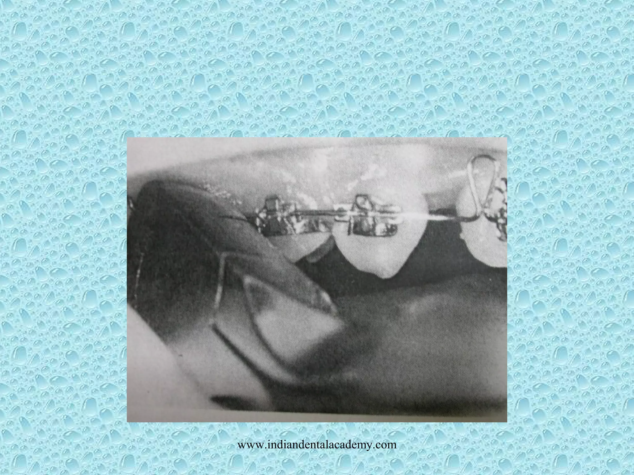 www.indiandentalacademy.com
 