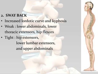 2. SWAY BACK
• Increased lordotic curve and kyphosis
• Weak : lower abdominals, lower
thoracic extensors, hip flexors
• Tight : hip extensors,
lower lumbar extensors,
and upper abdominals
60
 