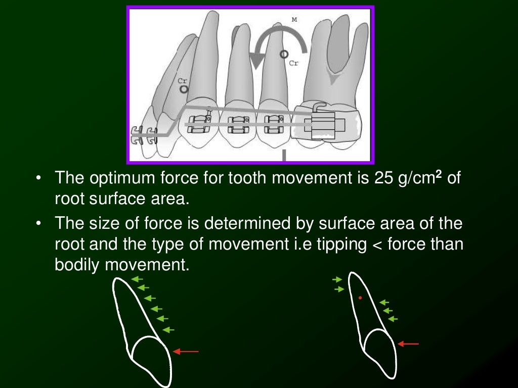 Biomechanics of Orthodontic Tooth Movement _2 Dr. Nabil AlZubair