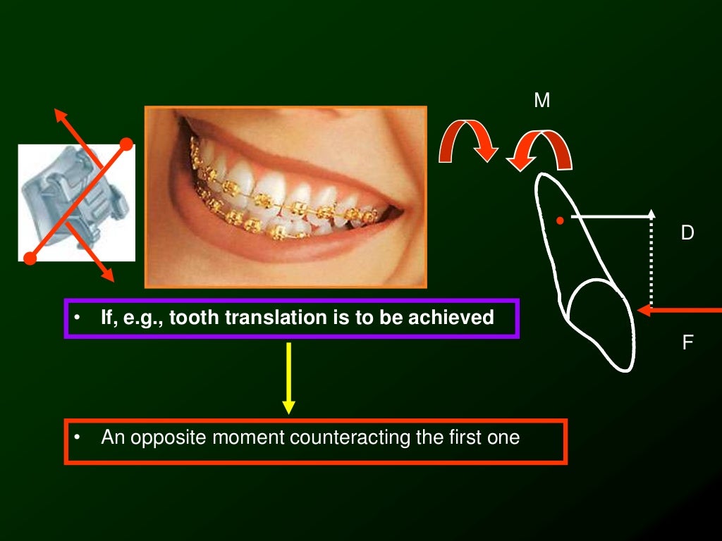 Biomechanics of Orthodontic Tooth Movement _2 Dr. Nabil AlZubair