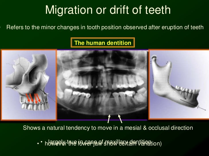 Biomechanics of Orthodontic Tooth Movement _2 Dr. Nabil AlZubair