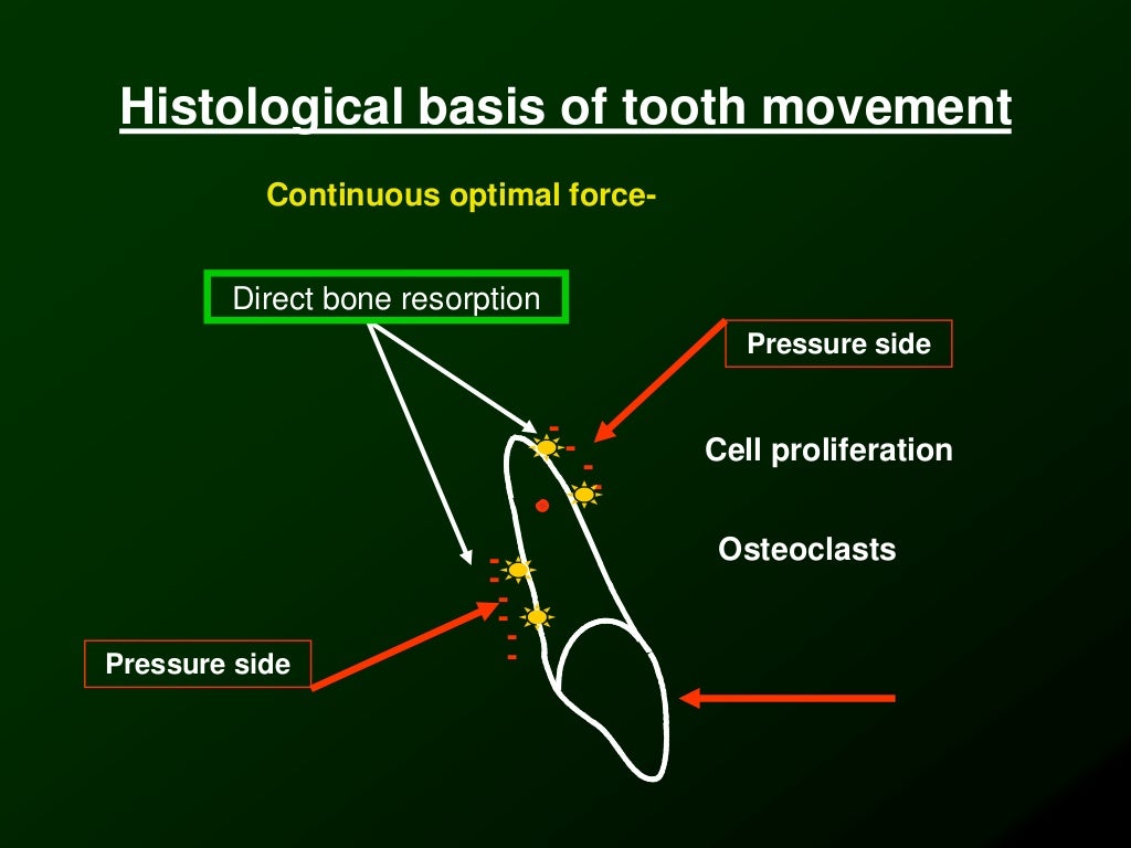 Biomechanics of Orthodontic Tooth Movement _2 Dr. Nabil AlZubair