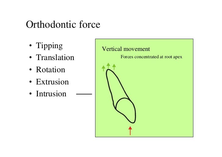Biomechanics of Othodontic Tooth Movement_ 1 Dr. Nabil AlZubair
