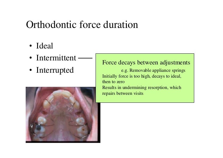 Biomechanics of Othodontic Tooth Movement_ 1 Dr. Nabil AlZubair