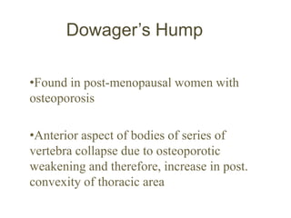 Dowager’s Hump
•Found in post-menopausal women with
osteoporosis
•Anterior aspect of bodies of series of
vertebra collapse due to osteoporotic
weakening and therefore, increase in post.
convexity of thoracic area
 