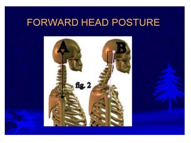 Biomechanics Of Posture