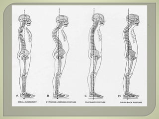 BIOMECHANICS OF POSTURE | PPTX