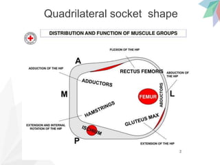 Biomechanics of Quadrilateral socket | PPTX