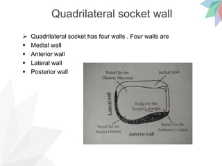 Quadrilateral socket wall
 Quadrilateral socket has four walls . Four walls are
 Medial wall
 Anterior wall
 Lateral wall
 Posterior wall
 