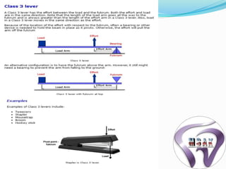 Biomechanics of rpd | PPTX