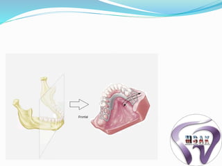 Tissue Ward Rotation Rpd Biomechanics of rpd | PPTX