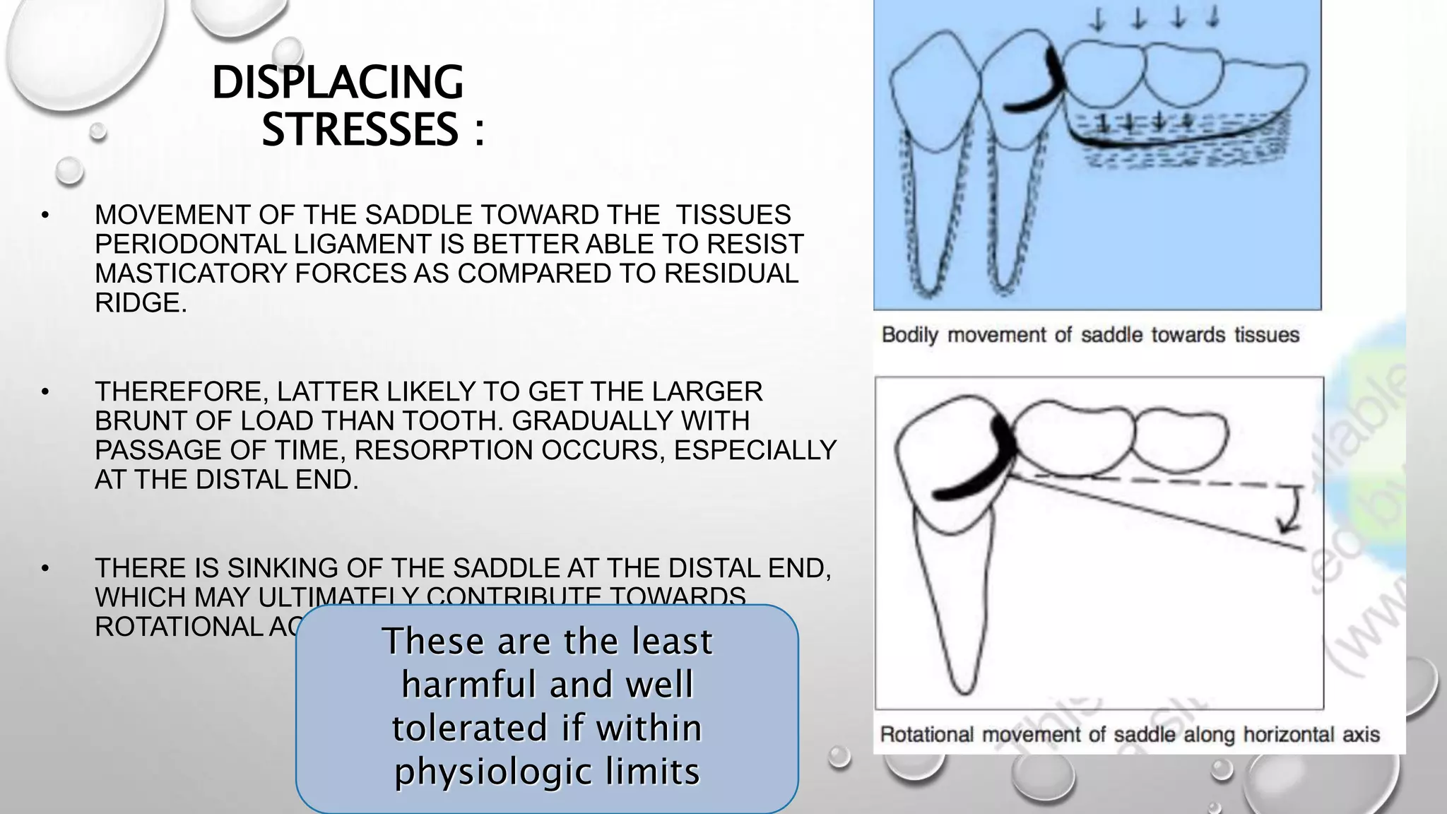 Biomechanics of RPD | PPTX