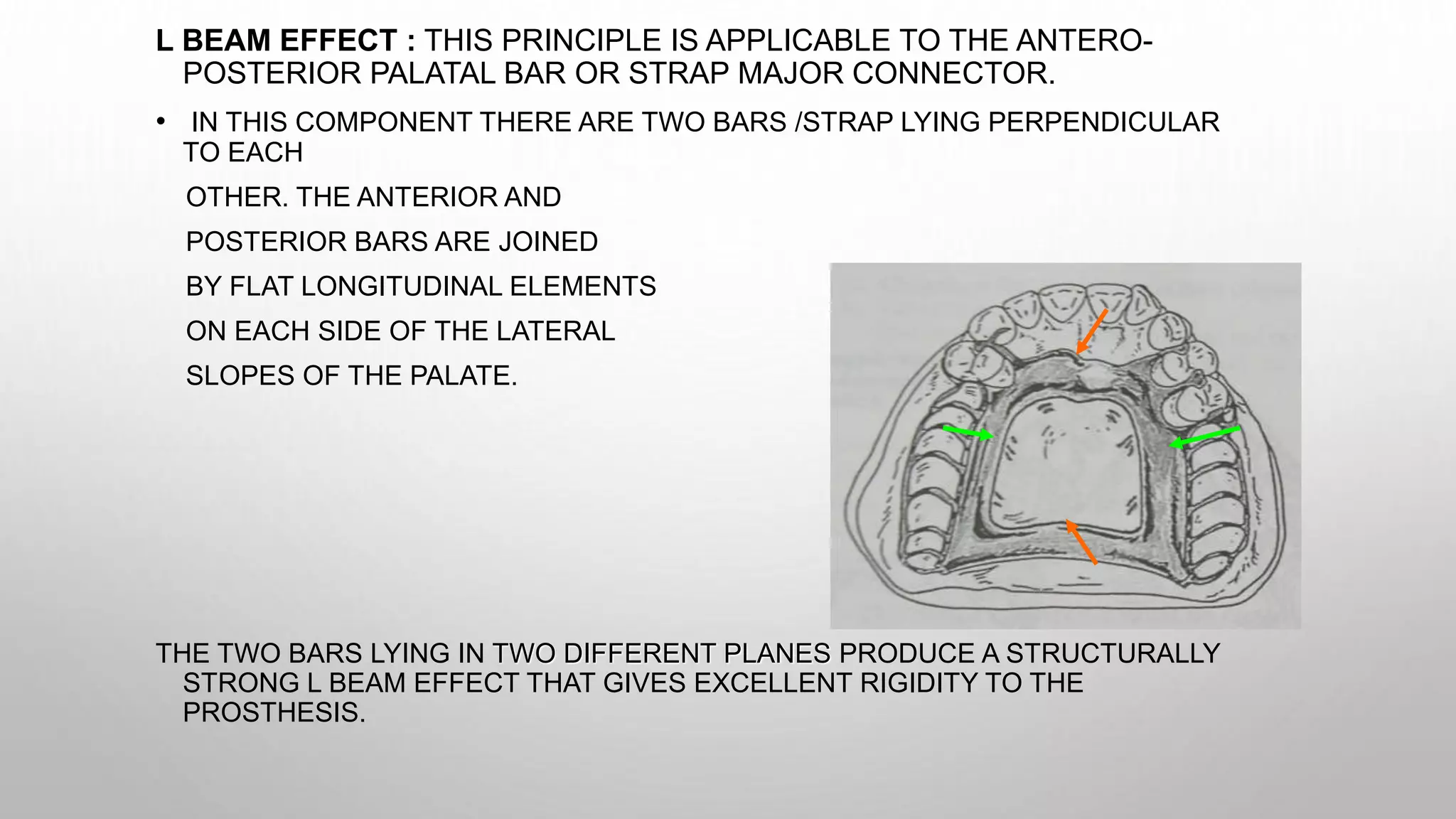 Frs Rpd Biomechanics of RPD | PPTX | Oral care | Personal Care