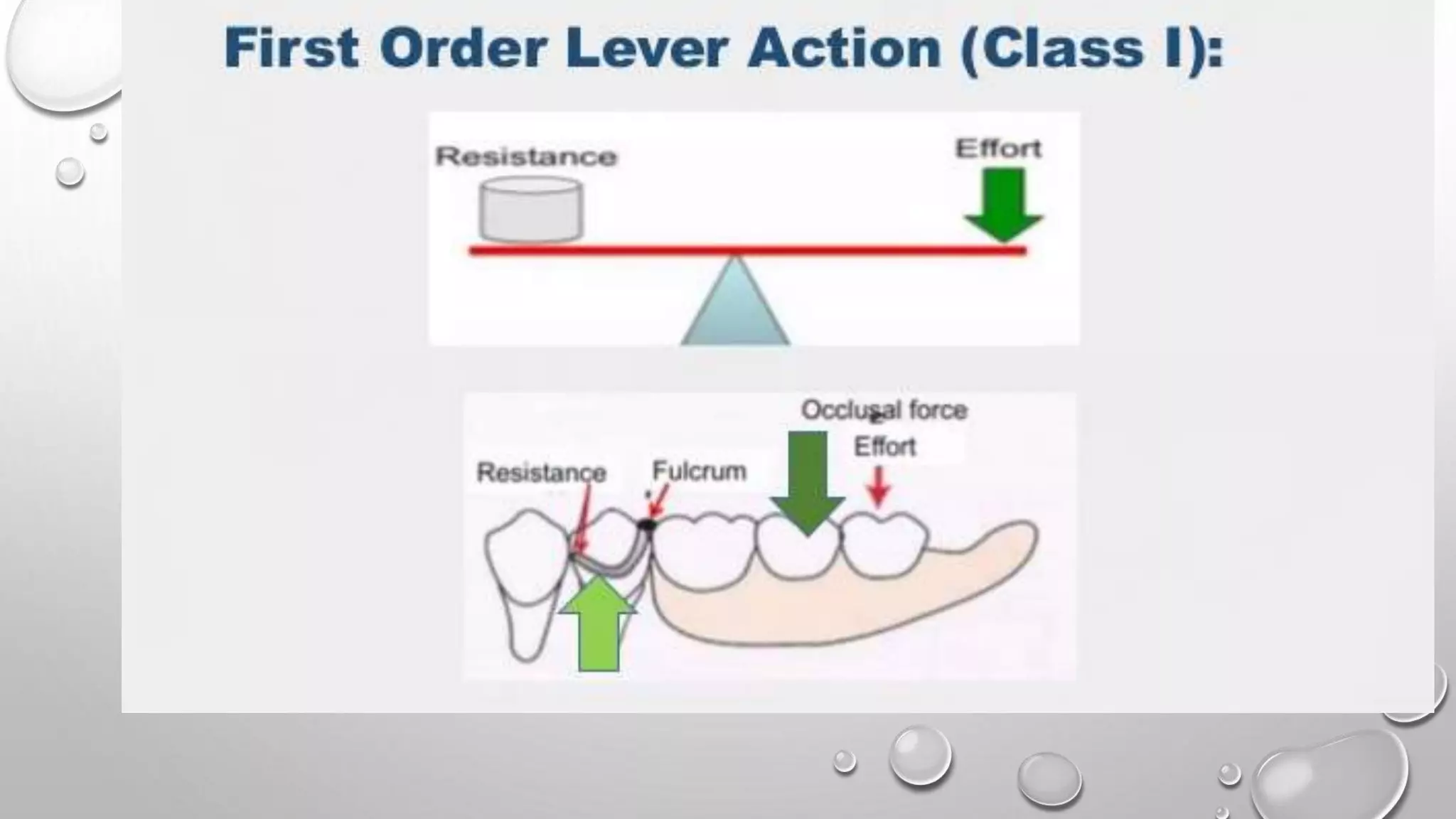 Lever Arm Rpd Biomechanics of RPD | PPTX