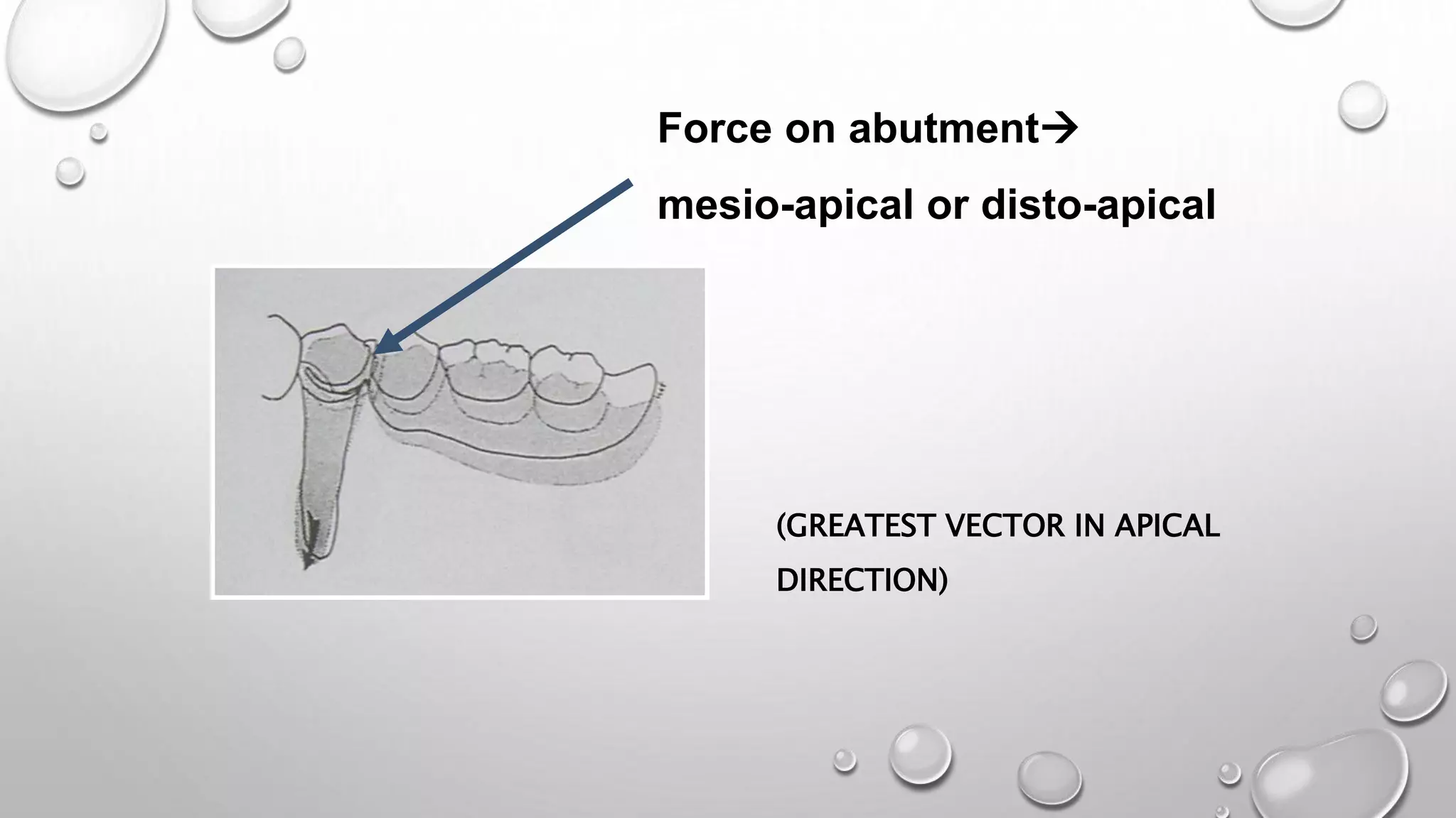Biomechanics of RPD | PPTX