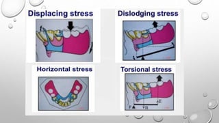 Frs Rpd Biomechanics of RPD | PPTX
