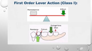 Tissue Ward Rotation Rpd Biomechanics of RPD | PPTX
