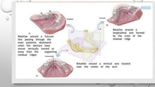 Tissue Ward Rotation Rpd Biomechanics of RPD | PPTX