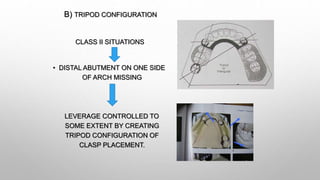 Biomechanics of RPD | PPTX