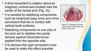Reciprocal Tooth biomechanics of removable partial dentur | PPTX