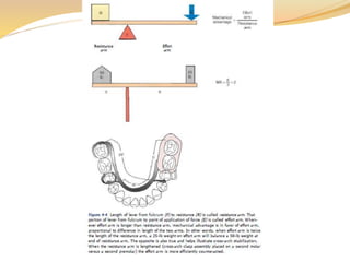 Biomechanics of RPD | PPTX