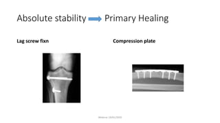 Biomechanics of stability pg course [recovered] | PPTX