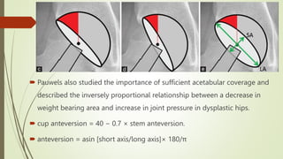Biomechanics of THA AIIMS JODHPUR SEMINAR | PPTX